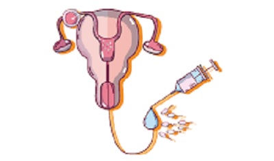 augmenter chances reussite insemination